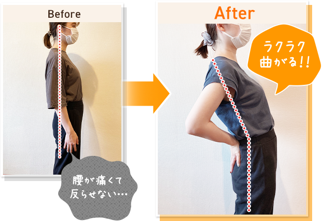 腰痛に悩んでいた伊丹市にお住まいのI様 Before After